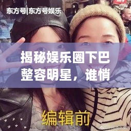 揭秘娛樂圈下巴整容明星，誰悄悄整過下巴？