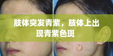 肢體突發(fā)青紫，肢體上出現(xiàn)青紫色斑 