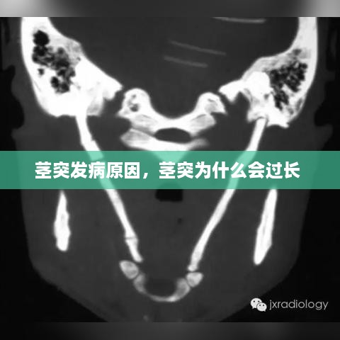 莖突發(fā)病原因，莖突為什么會過長 