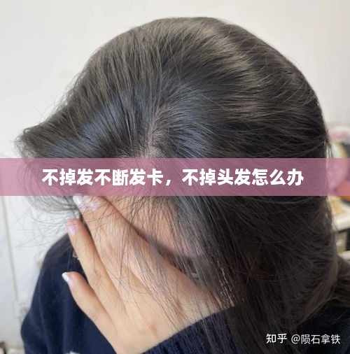 不掉發(fā)不斷發(fā)卡，不掉頭發(fā)怎么辦 