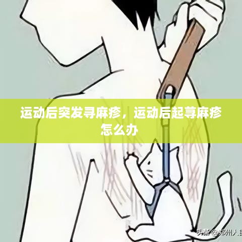 運(yùn)動后突發(fā)尋麻疹，運(yùn)動后起蕁麻疹怎么辦 