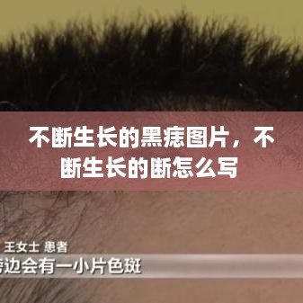不斷生長的黑痣圖片，不斷生長的斷怎么寫 