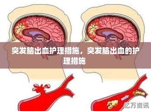 突發(fā)腦出血護理措施，突發(fā)腦出血的護理措施 