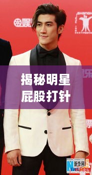 揭秘明星屁股打針背后的真相、誤解與公眾關(guān)注焦點(diǎn)