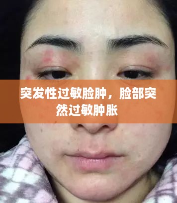 突發(fā)性過(guò)敏臉腫，臉部突然過(guò)敏腫脹 