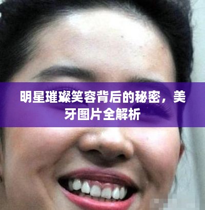 明星璀璨笑容背后的秘密，美牙圖片全解析