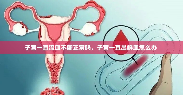 子宮一直流血不斷正常嗎，子宮一直出鮮血怎么辦 