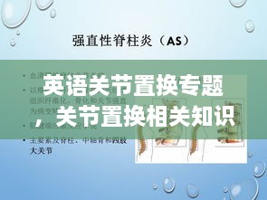 英語(yǔ)關(guān)節(jié)置換專題，關(guān)節(jié)置換相關(guān)知識(shí) 