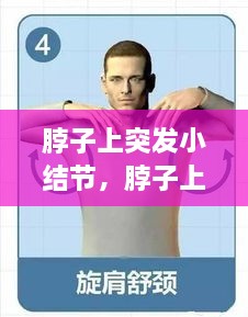 脖子上突發(fā)小結節(jié)，脖子上的小結節(jié)要緊嗎 